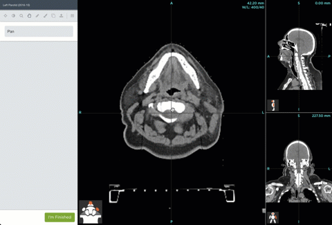 cap-6.gif