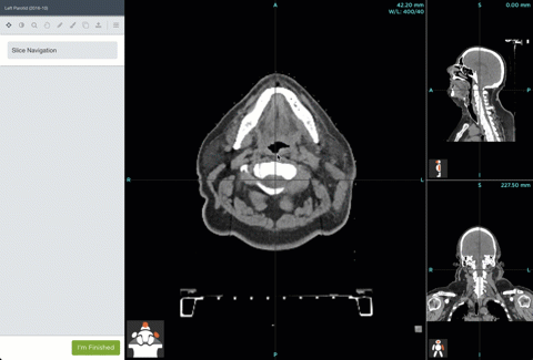 cap-3.gif