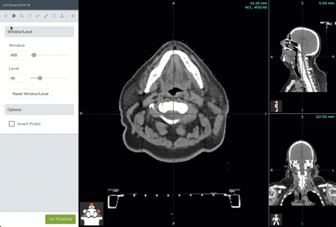 cap-4.gif