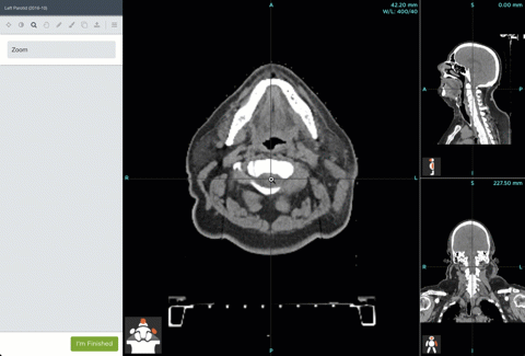 cap-5.gif